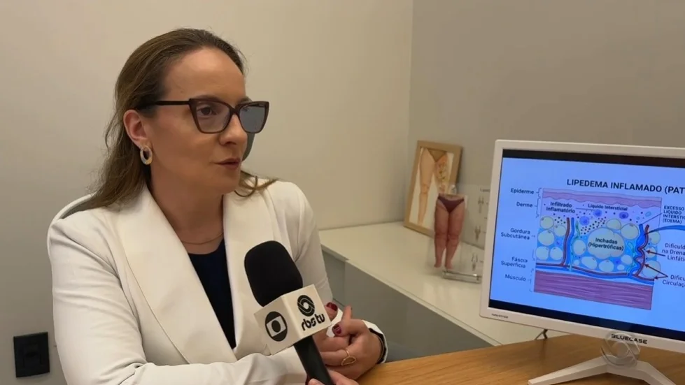 Falta de diagnóstico ainda é um dos principais desafios para mulheres com lipedema